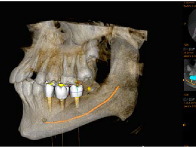 FOTO RADIOLOGIA DENTAL WEB